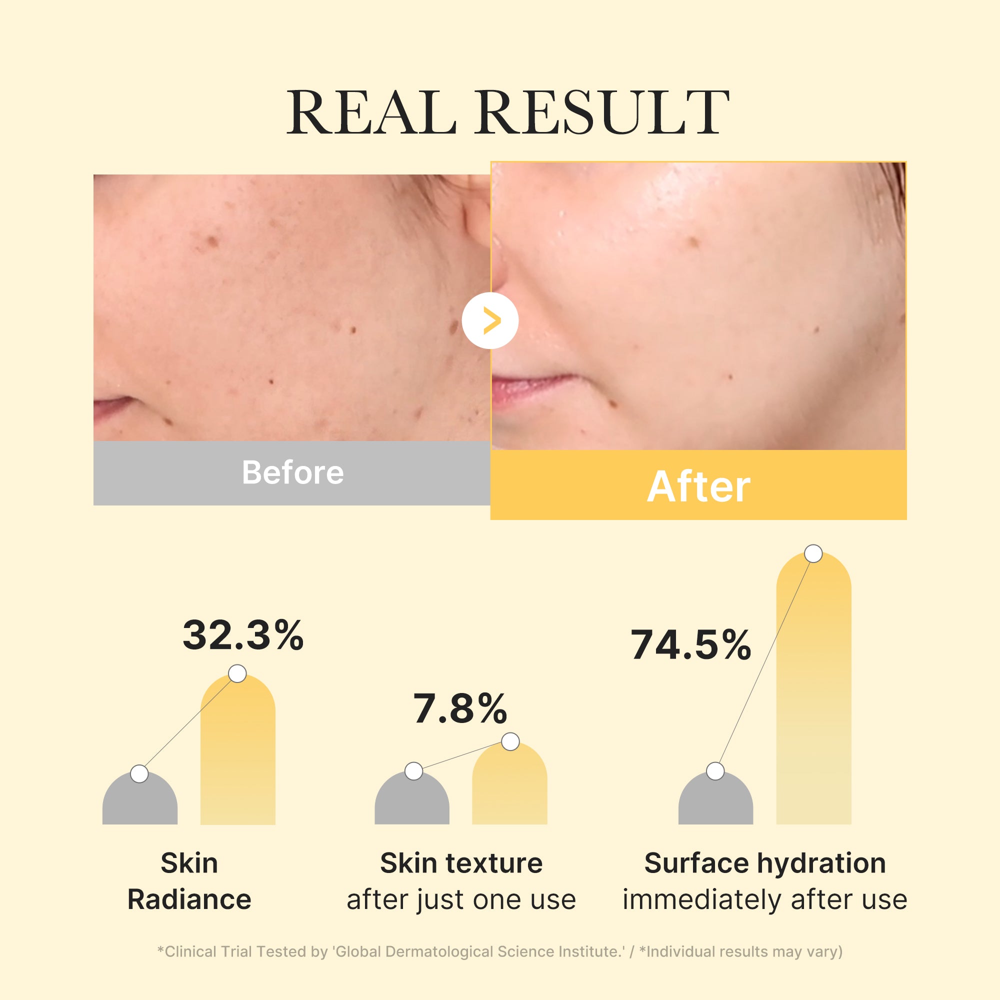 Masque Gelée Or Curcuma & Kojic — Teint Éclatant & Unifié