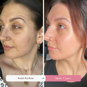 Routine Coréenne 5-en-1 Anti-Âge au Triple Collagène