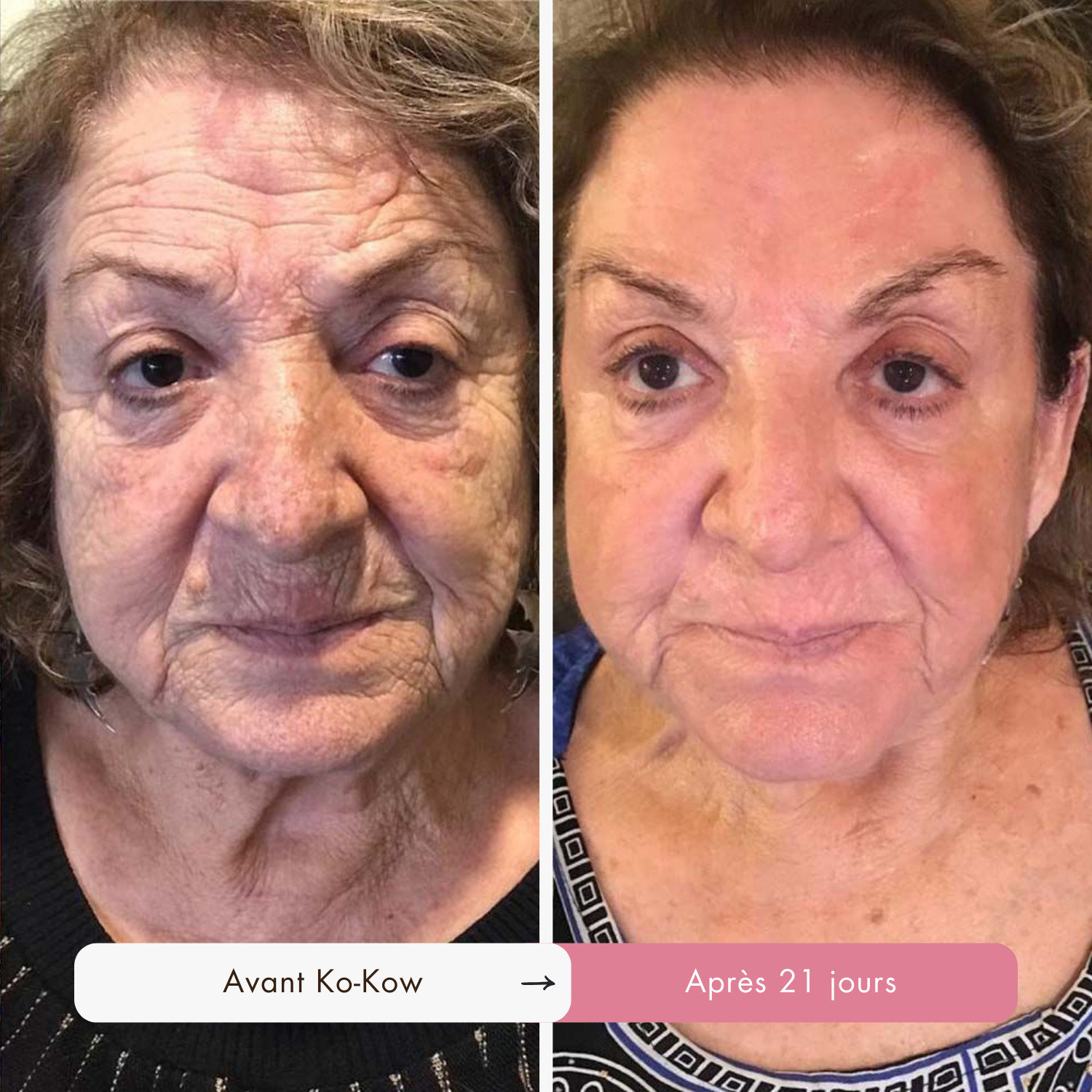 Routine Coréenne 5-en-1 Anti-Âge au Triple Collagène