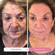 Routine Coréenne 5-en-1 Anti-Âge au Triple Collagène