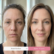 Pack Glow Profond & Rajeunissement Instantané