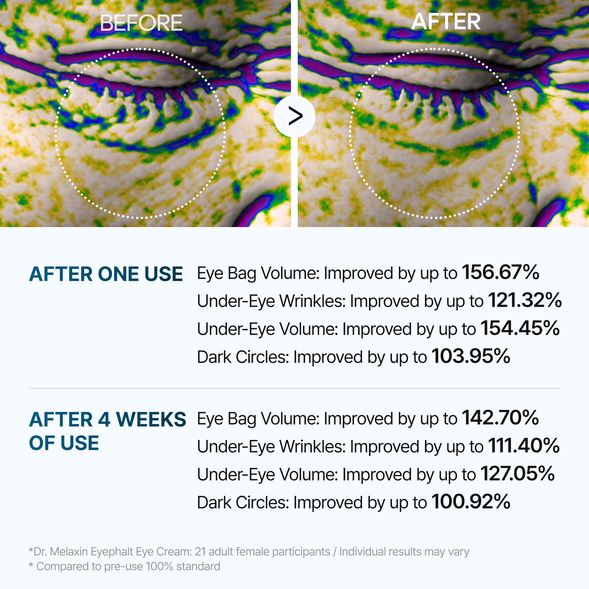 Crème Contour Yeux Eyephalt Adieu Cernes Et Poches