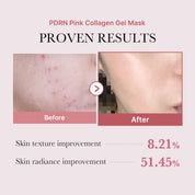 Masque Gelée Rose au Collagène & PDRN — Réparation & Glow Instantané
