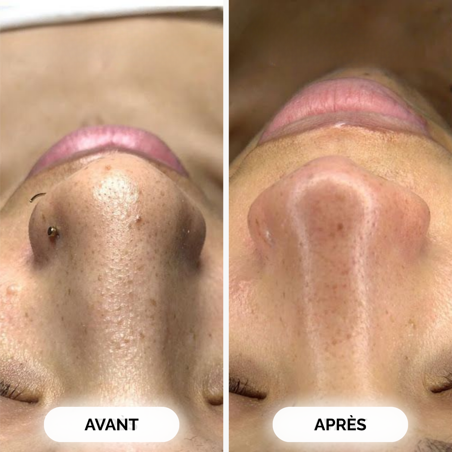 Zero Pore Pads Pores Resserrés Et Grain Affiné